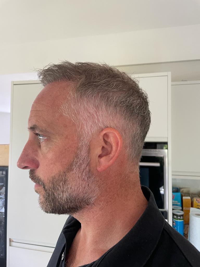 Progressive recovery